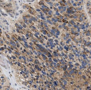 GPAA1 Rabbit Polyclonal Antibody