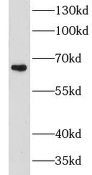 GPATCH2 Rabbit Polyclonal Antibody