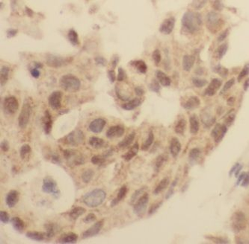 GPATCH2 Rabbit Polyclonal Antibody