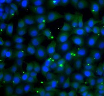 GPI Rabbit Polyclonal Antibody