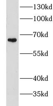 GPNMB Rabbit Polyclonal Antibody