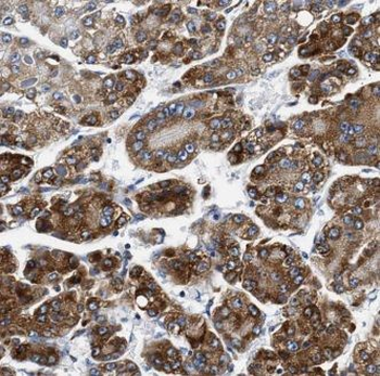 GPNMB Rabbit Polyclonal Antibody