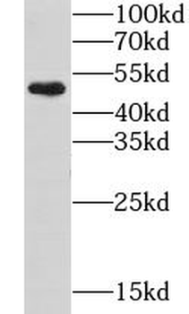 GPR17 Rabbit Polyclonal Antibody