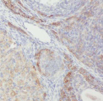 WLS Rabbit Polyclonal Antibody