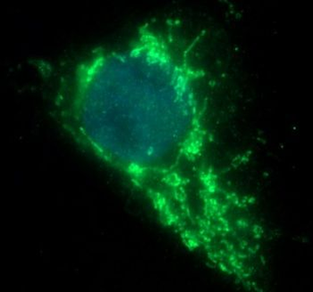 GPR50 Rabbit Polyclonal Antibody