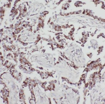 GPRC5A Rabbit Polyclonal Antibody