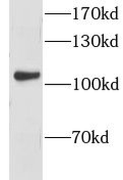 GPRIN1 Rabbit Polyclonal Antibody