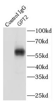 GPT2 Rabbit Polyclonal Antibody