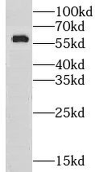 GPT2 Rabbit Polyclonal Antibody
