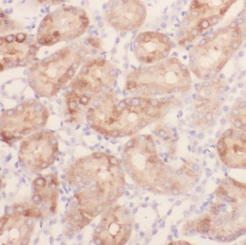 GPT2 Rabbit Polyclonal Antibody