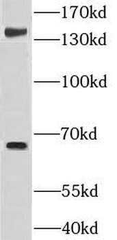 GRAMD4 Rabbit Polyclonal Antibody