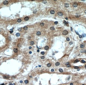 GREM2 Antibody