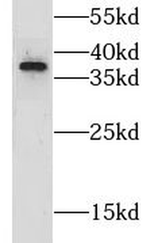 GRHPR Rabbit Polyclonal Antibody