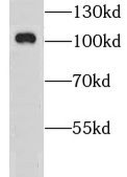 GRIA4 Rabbit Polyclonal Antibody