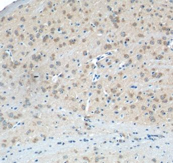 GRIA4 Rabbit Polyclonal Antibody
