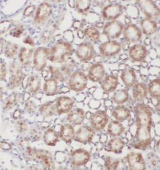 GRIP1 Rabbit Polyclonal Antibody