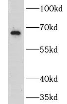 GRK6 Rabbit Polyclonal Antibody