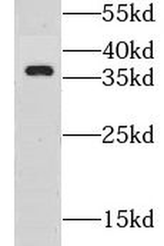 GSG1L Rabbit Polyclonal Antibody
