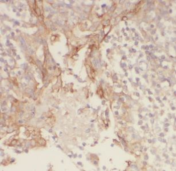 GSG1L Rabbit Polyclonal Antibody
