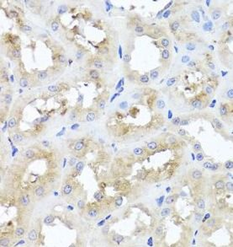 GSK3B Rabbit Polyclonal Antibody