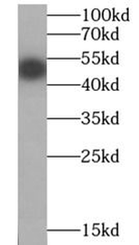 GSK3B Rabbit Polyclonal Antibody