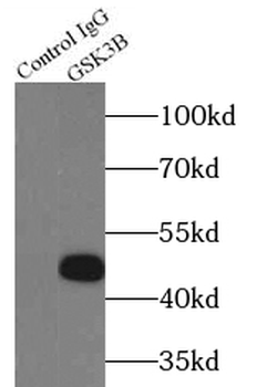 GSK3B Rabbit Polyclonal Antibody