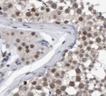 GSK3B Rabbit Polyclonal Antibody