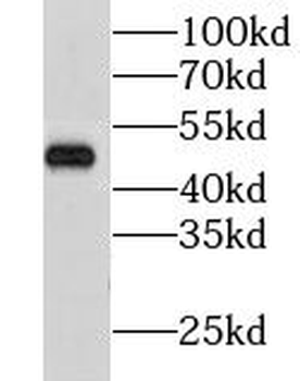 GSK3B Rabbit Polyclonal Antibody
