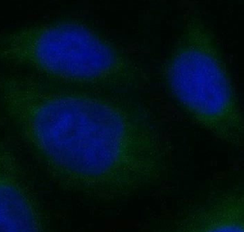 GSK3B Rabbit Polyclonal Antibody