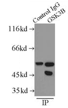 GSK3B Rabbit Polyclonal Antibody