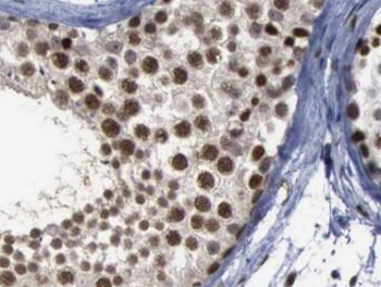 GSK3B Rabbit Polyclonal Antibody