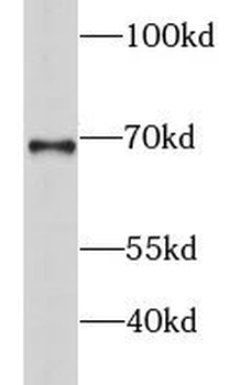 GSPT2 Rabbit Polyclonal Antibody