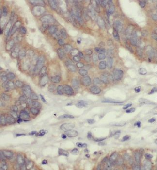 GSPT2 Rabbit Polyclonal Antibody