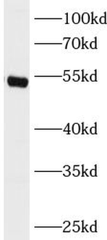 GSR Antibody