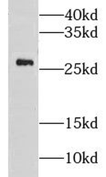 GSTA1 Antibody