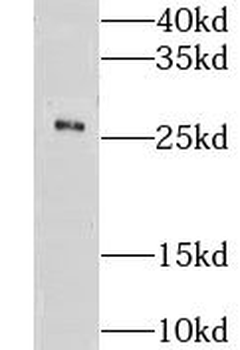 GSTA4 Rabbit Polyclonal Antibody