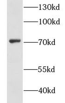 GSTCD Rabbit Polyclonal Antibody