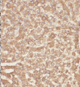 GSTCD Rabbit Polyclonal Antibody