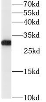 GSTO1 Mouse Monoclonal Antibody