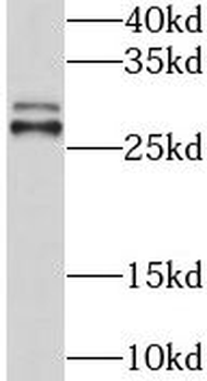 GSTT1 Rabbit Polyclonal Antibody