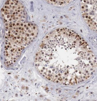GTDC1 Rabbit Polyclonal Antibody
