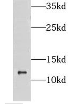GTF2A2 Rabbit Polyclonal Antibody
