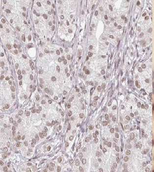 GTF2A2 Rabbit Polyclonal Antibody