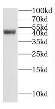 GTF2H2C Antibody