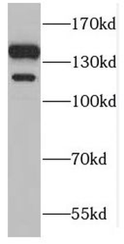 GTF2IRD1 Rabbit Polyclonal Antibody