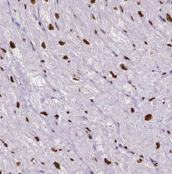GTF2IRD1 Rabbit Polyclonal Antibody