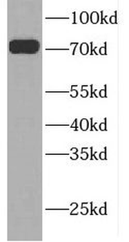 GTPBP1 Rabbit Polyclonal Antibody