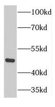 GTPBP3 Rabbit Polyclonal Antibody