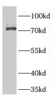 GTSE1 Antibody