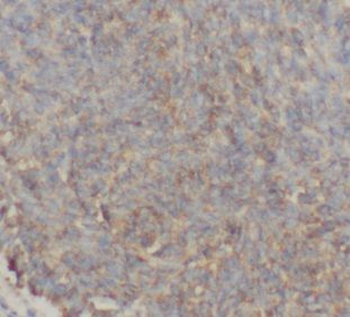 GTSE1 Antibody